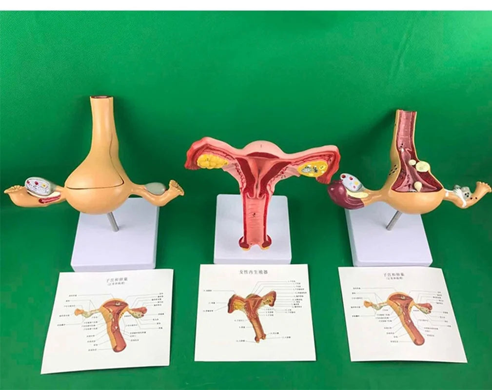 Ovary and uterus disease Dissection Pathology Female 4D Medical instrument Human Anatomy Anatomical Model Science