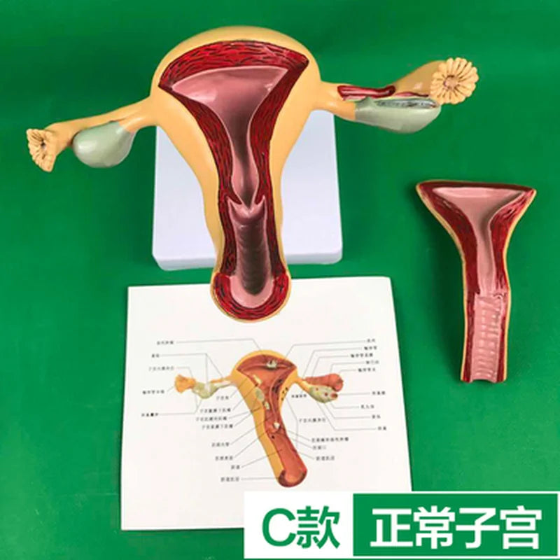 Ovary and uterus disease Dissection Pathology Female 4D Medical instrument Human Anatomy Anatomical Model Science