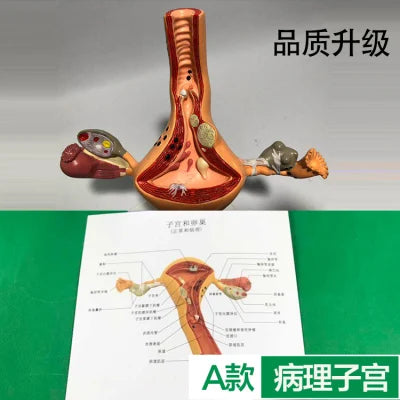 Ovary and uterus disease Dissection Pathology Female 4D Medical instrument Human Anatomy Anatomical Model Science