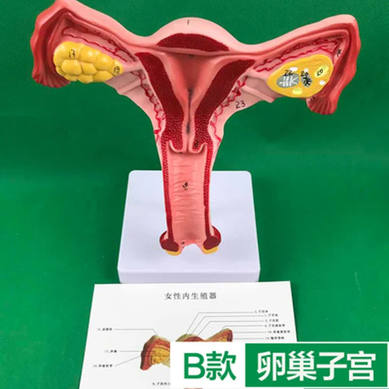 Ovary and uterus disease Dissection Pathology Female 4D Medical instrument Human Anatomy Anatomical Model Science