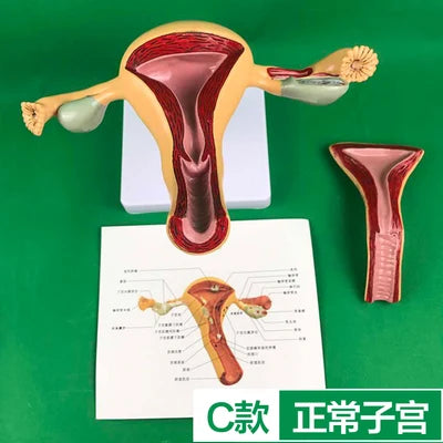Ovary and uterus disease Dissection Pathology Female 4D Medical instrument Human Anatomy Anatomical Model Science