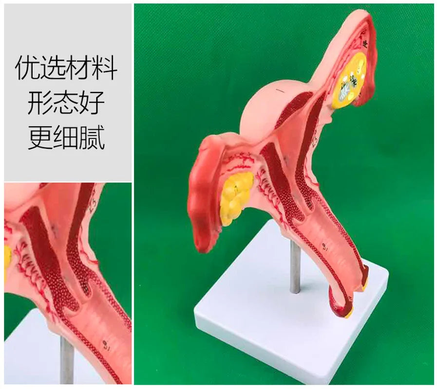 Ovary and uterus disease Dissection Pathology Female 4D Medical instrument Human Anatomy Anatomical Model Science