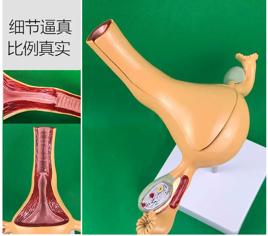 Ovary and uterus disease Dissection Pathology Female 4D Medical instrument Human Anatomy Anatomical Model Science
