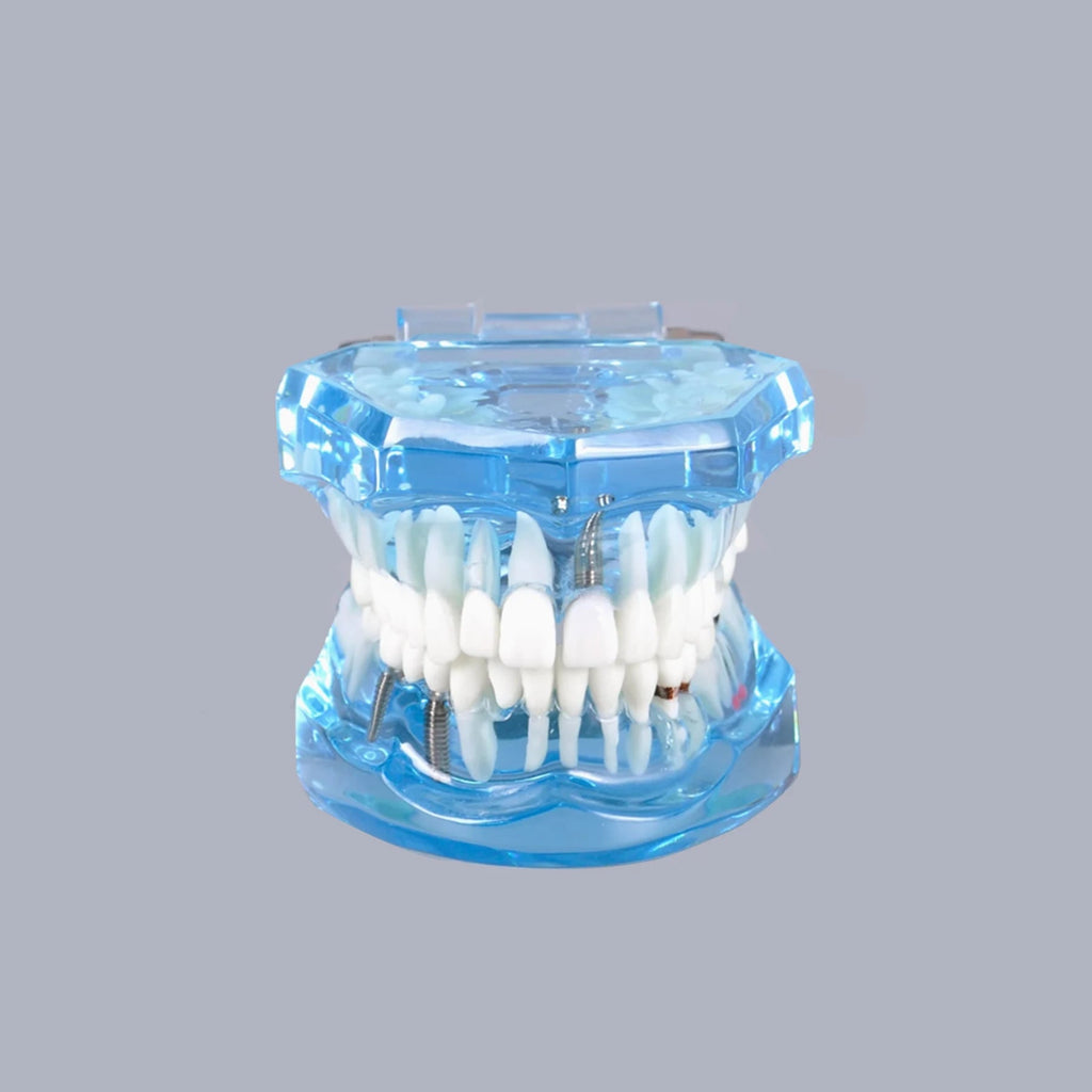 4D Human Teeth Model Dental laboratory Implant Disease Repairable Resin Models Dentist Dental Student Learning Teaching Research Communication