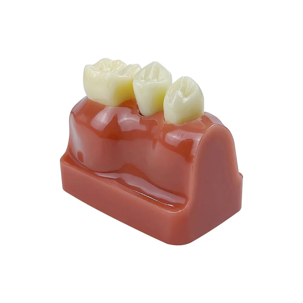 4D Human Teeth Model Decorative Analysis Model Crown Bridge Demonstration Teaching Model, Removable Training Study, 4 Times