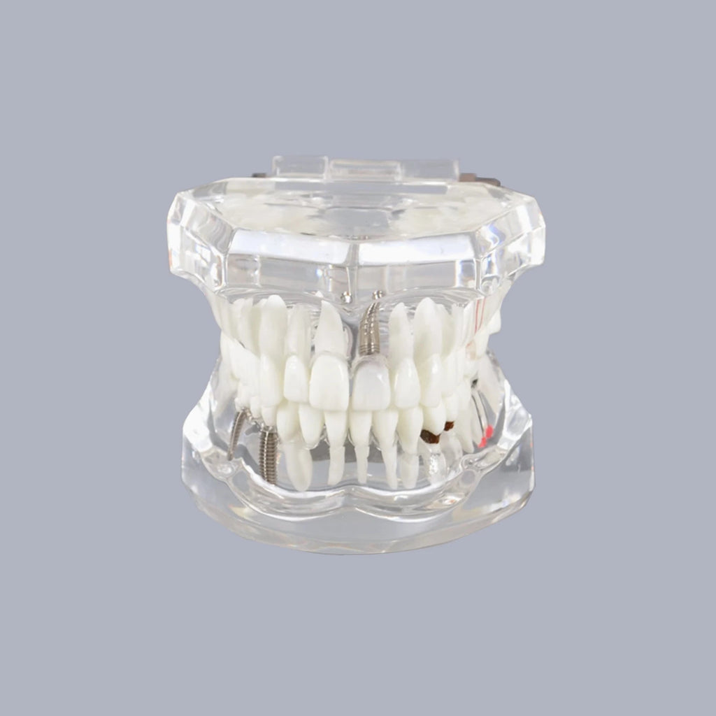 4D Human Teeth Model Dental laboratory Implant Disease Repairable Resin Models Dentist Dental Student Learning Teaching Research Communication