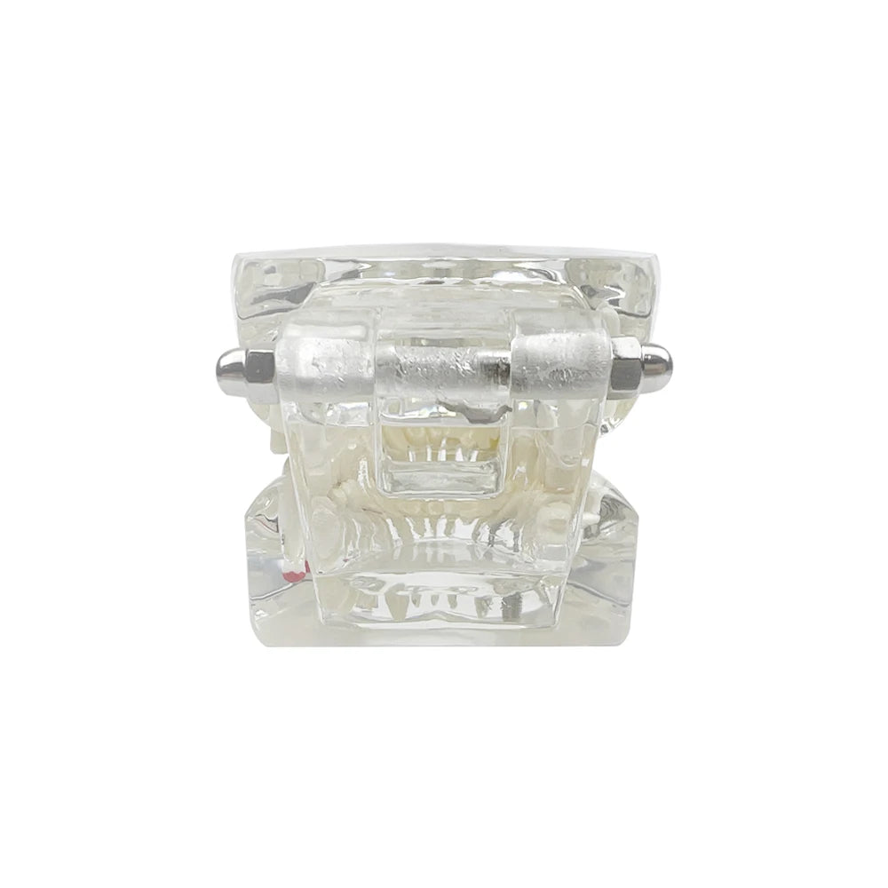 4D Human Teeth Model Dental Transparent Disease Typodont Implant With Removable Tooth Restoration Bridge Teaching Research