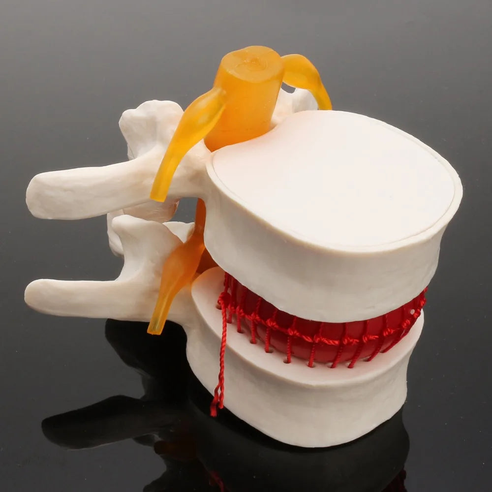 Skeleton Spine Lumbar Disc Herniation Teaching Model 4D Medical instrument Human Anatomy Anatomical Model Science