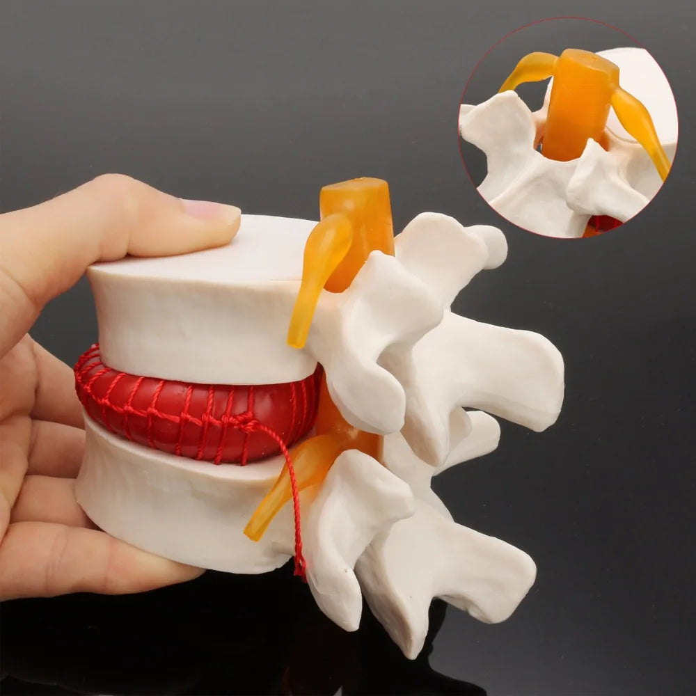 Skeleton Spine Lumbar Disc Herniation Teaching Model 4D Medical instrument Human Anatomy Anatomical Model Science