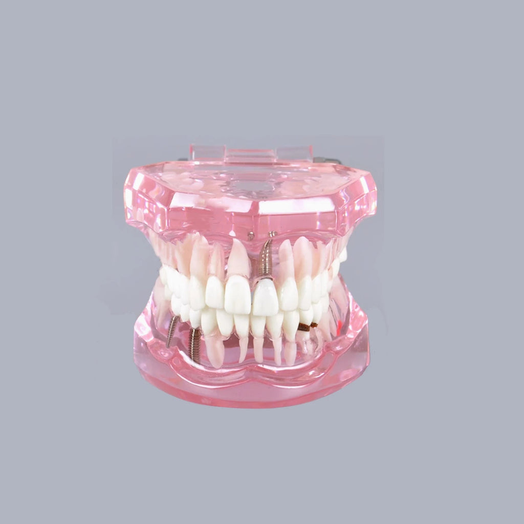4D Human Teeth Model Dental laboratory Implant Disease Repairable Resin Models Dentist Dental Student Learning Teaching Research Communication
