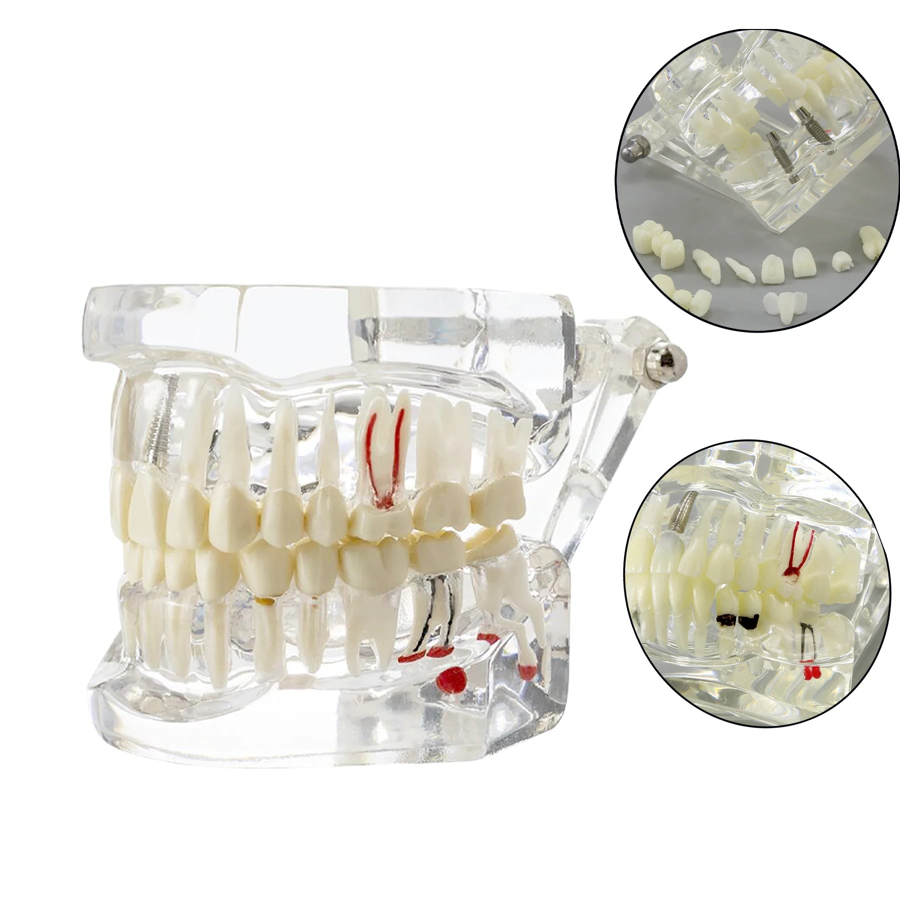 4D Human Teeth Model Dental laboratory Implant Disease Repairable Resin Models Dentist Dental Student Learning Teaching Research Communication