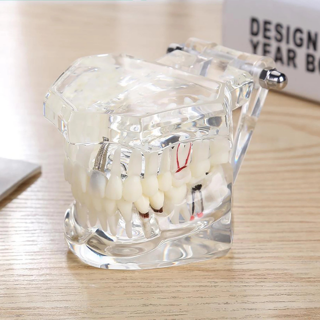 4D Human Teeth Model Dental laboratory Implant Disease Repairable Resin Models Dentist Dental Student Learning Teaching Research Communication