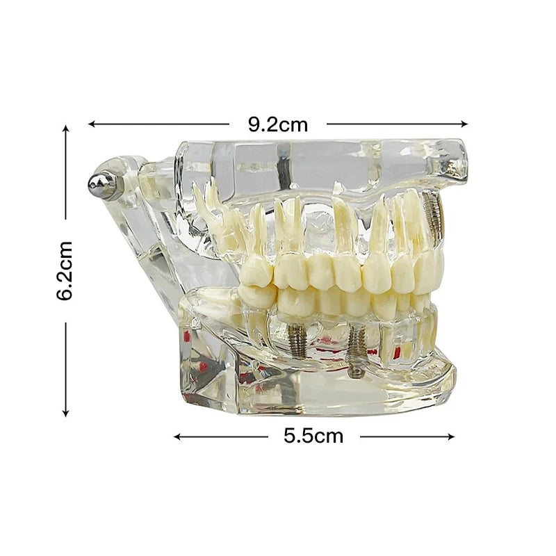 4D Human Teeth Model  Dental Diseases Tooth Model Repairable Resin Models Of Diseased Teeth For Teaching And Research
