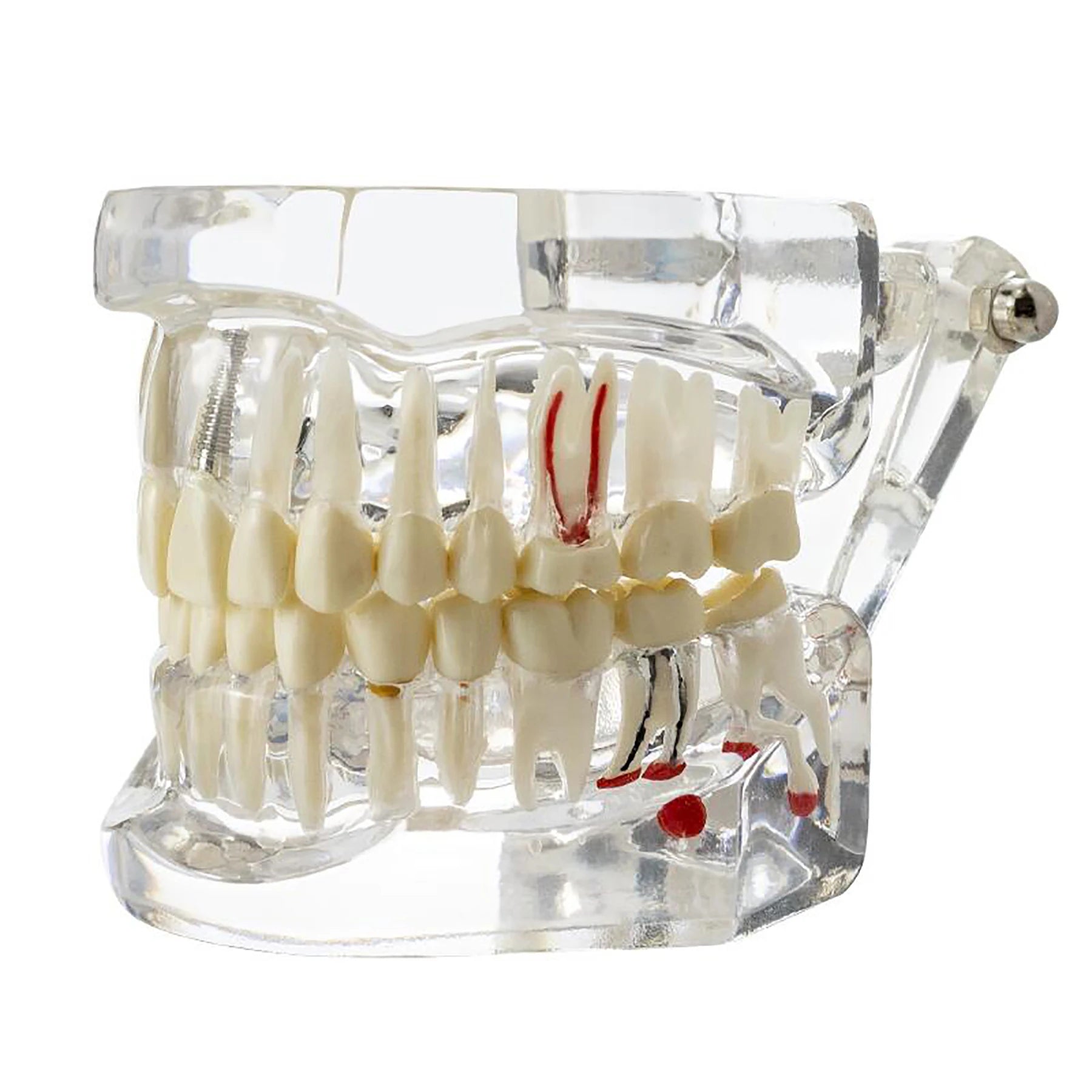 4D Human Teeth Model Dental laboratory Implant Disease Repairable Resin Models Dentist Dental Student Learning Teaching Research Communication