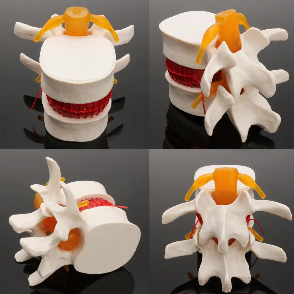 Skeleton Spine Lumbar Disc Herniation Teaching Model 4D Medical instrument Human Anatomy Anatomical Model Science